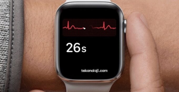 Apple Watch detects another heart condition