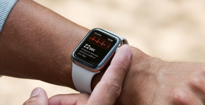 Apple Watch Tops the List in ECG Readability, According to Researchers